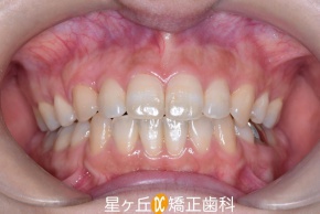 After