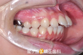 Before