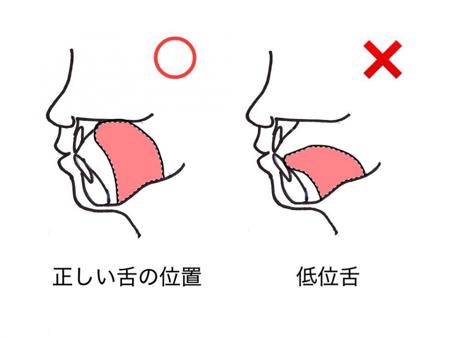 image:正しい舌の位置