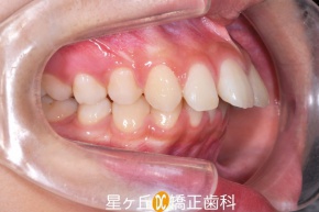 Before