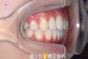 After