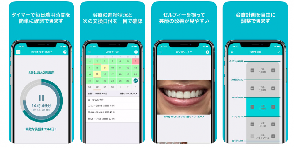 image:インビザライン(マウスピース矯正)のための便利なアプリ